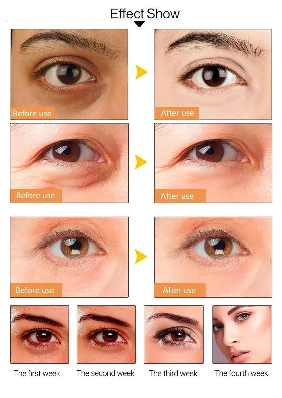 Gold Collagen Eye Masks - Revitalize, Hydrate & Erase Dark Circles & Puffiness