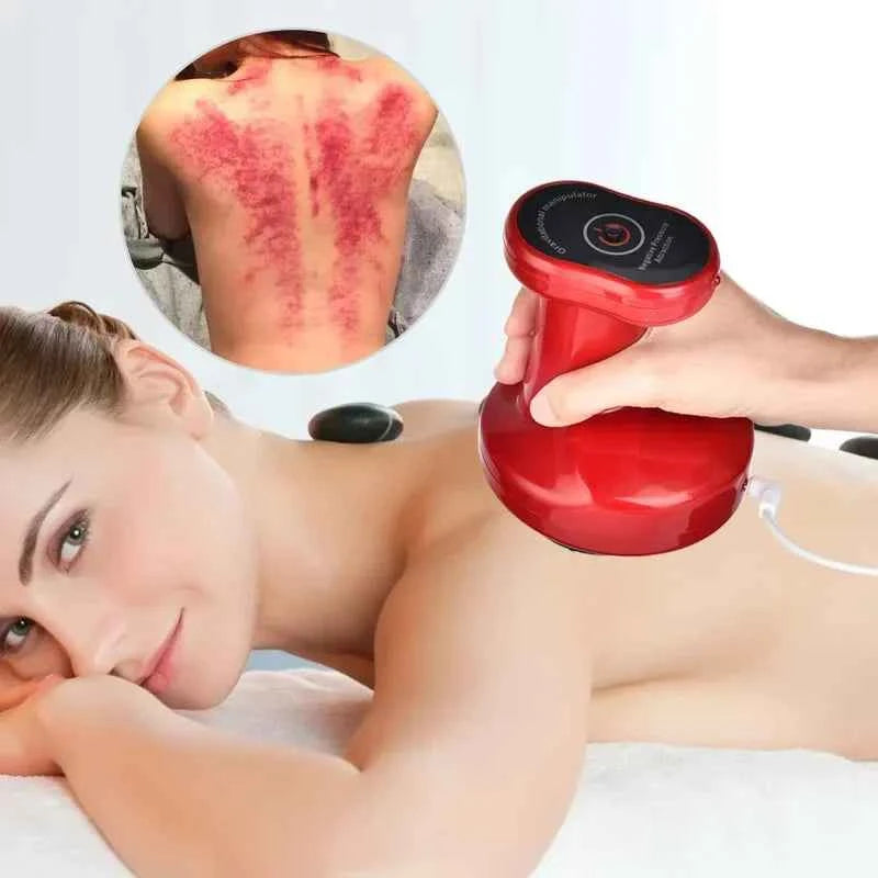 Revitalize Body & Mind Electric Cupping Massager with Infrared Heat & Suction for Cellulite Reduction