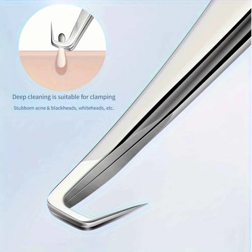 High-Precision Blackhead Remover Tweezers Set – Professional Pimple Extractor & Hair Removal Tools for Flawless Skin