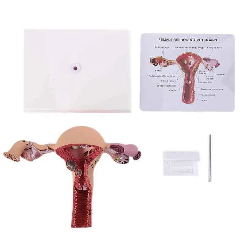 Medical props model Human Female Pathological Uterus Ovary Model Anatomical Disease Pathology Medical Lesion ForBiology Teaching