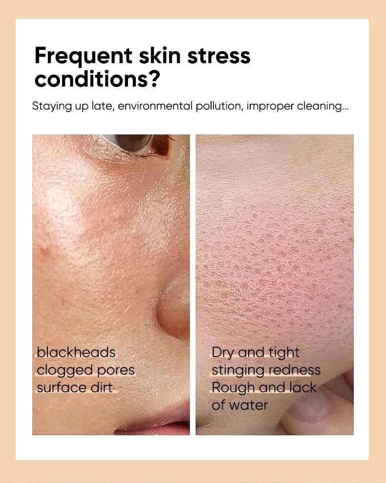 120ml Hydrating 7% Glycolic Acid Face Toner AHA Pore Minimizing Serum Facial Exfoliating Moisturizing Face Lotion