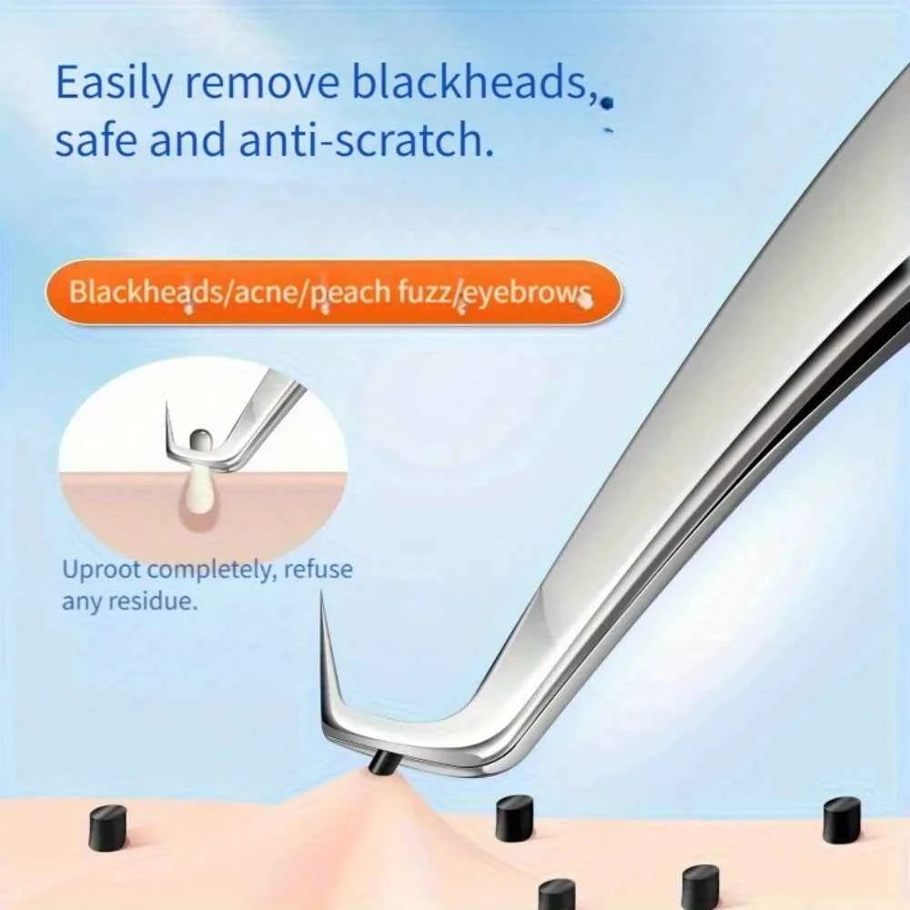 High-Precision Blackhead Remover Tweezers Set – Professional Pimple Extractor & Hair Removal Tools for Flawless Skin