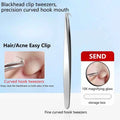 High-Precision Blackhead Remover Tweezers Set – Professional Pimple Extractor & Hair Removal Tools for Flawless Skin