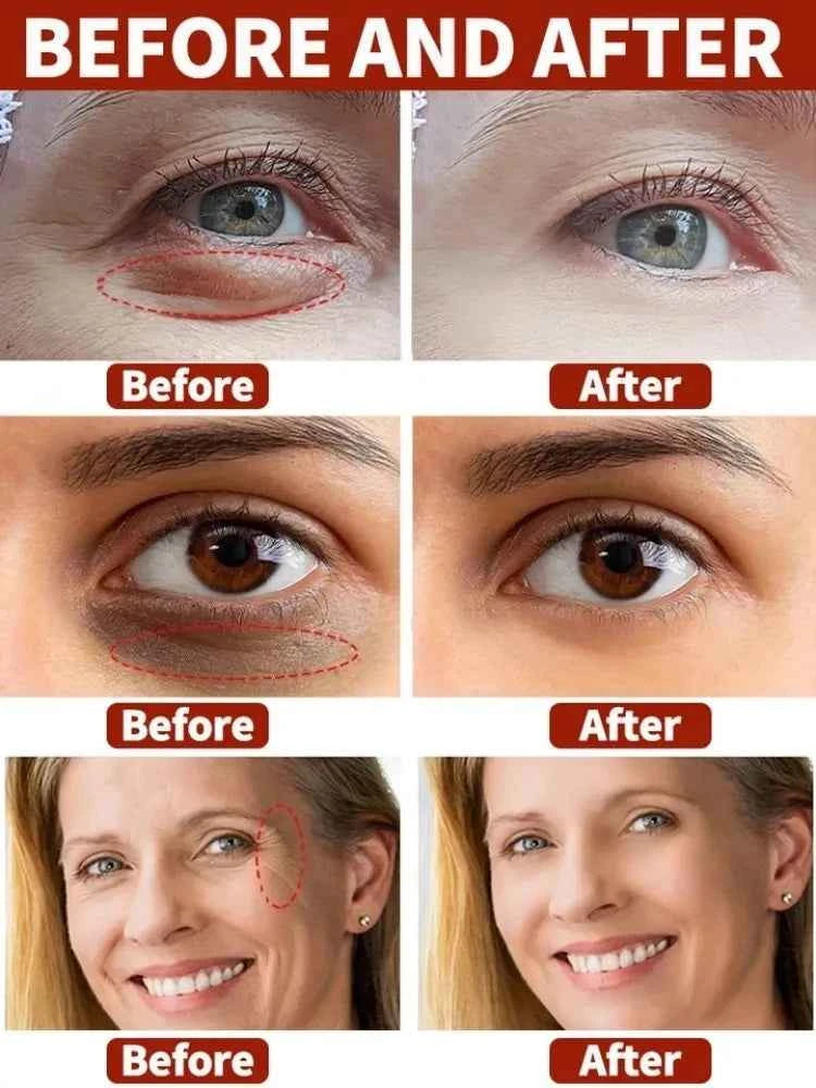 Anti-wrinkle Oxys Cream Wrinkle Face Cream Anti-Aging Face Lift Facial Massagers Facial Lift Wrinkles Remover Skin Product