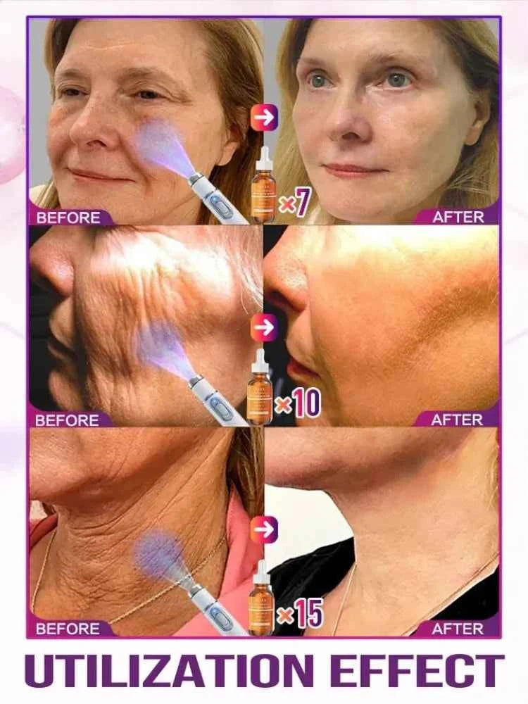 Anti-wrinkle Oxys Cream Wrinkle Face Cream Anti-Aging Face Lift Facial Massagers Facial Lift Wrinkles Remover Skin Product